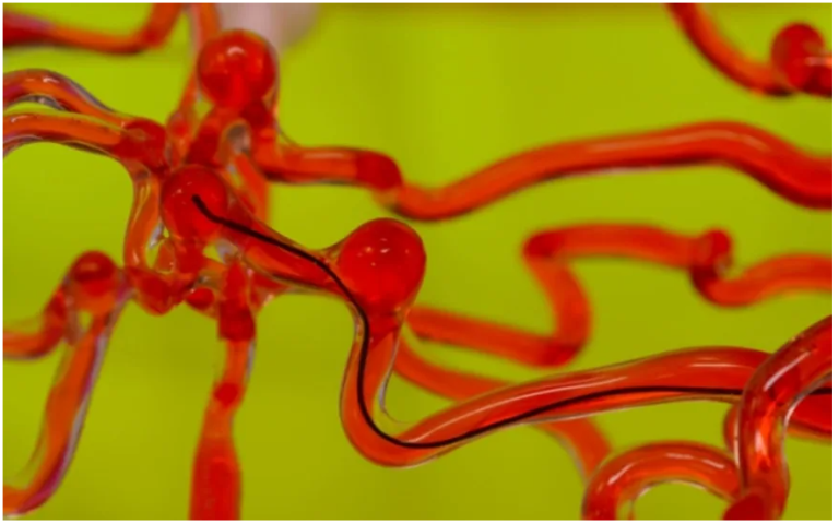 MIT’s thread-like robot can slip through blood vessels in your brain