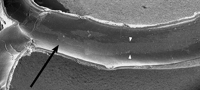 Surface modification of neurovascular stents: from bench to patient