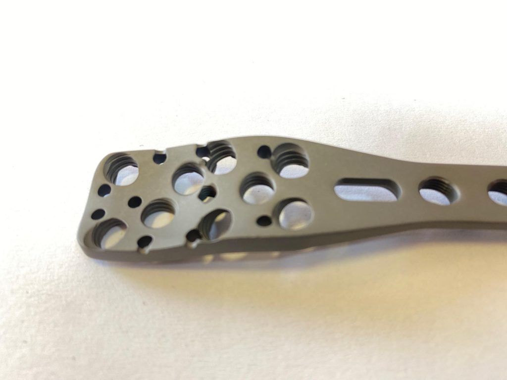 Poliaxialitatea placilor si suruburilor ajuta la adaptarea cat mai anatomica a implantului la tipul de fractura. Placile si suruburile sunt tratate la suprafata cu un strat oxidativ (anodizare), ceea ce permite ca acestea, in timp, sa nu se ”sudeze la rece” si sa poata fi desfacute usor si indepartate, in cazul in care pacientul opteaza sau medicul recomanda aceasta.