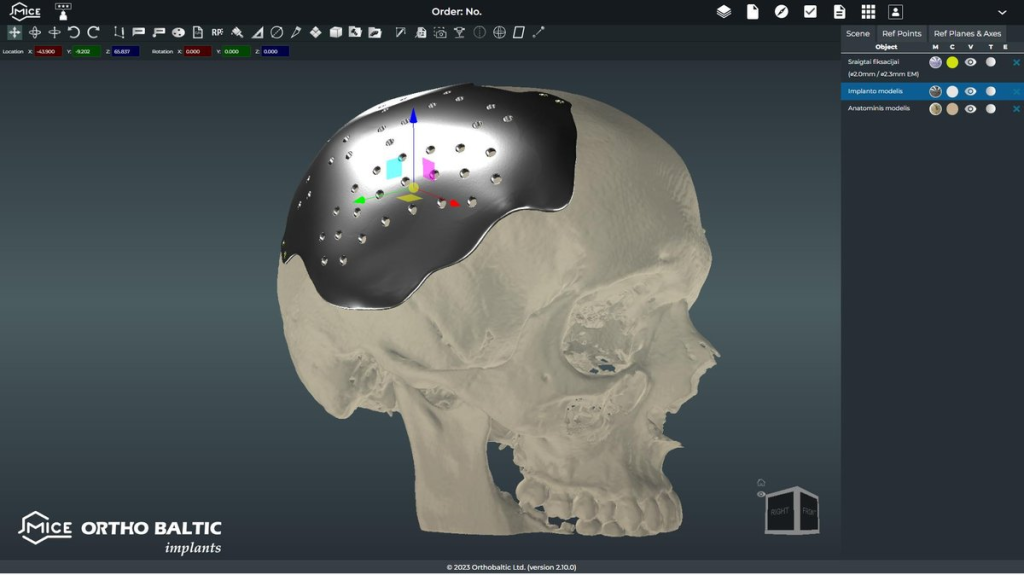 MICE, the Medical Implants AI-Driven 3D Customization Engine, is a cutting-edge, web-based 3D product design configuration and pre-surgical planning software. This innovative platform is specifically designed to facilitate the active involvement of surgeons in patient-specific implants and surgical guides ordering and design validation processes. As a groundbreaking tool, MICE aims to transform into the standard of communication between surgeons and manufacturers for pre-surgical planning in a 3D environment and for processing orders for patient-specific implants and surgical guides.