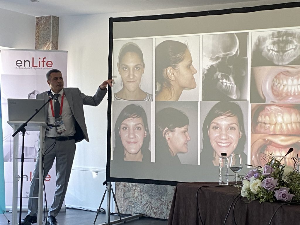 Ortognathic surgery: between aestetics and functionality
Simion Bran (Romania)