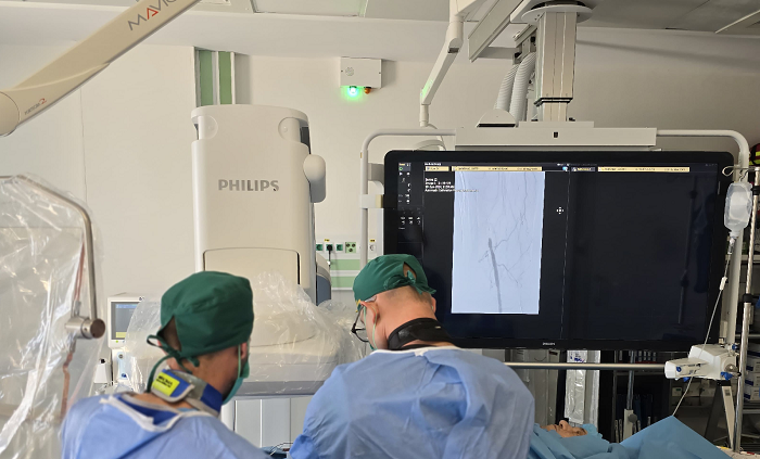Premiera medicala la Cluj-Napoca: Primul stent intracerebral implantat cu succes la un pacient cu stenoza severa a arterei bazilare