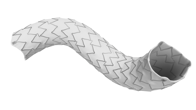 First patient enrolled in iVascular’s fenCo study, advancing clinical assessment of iCover in FEVAR