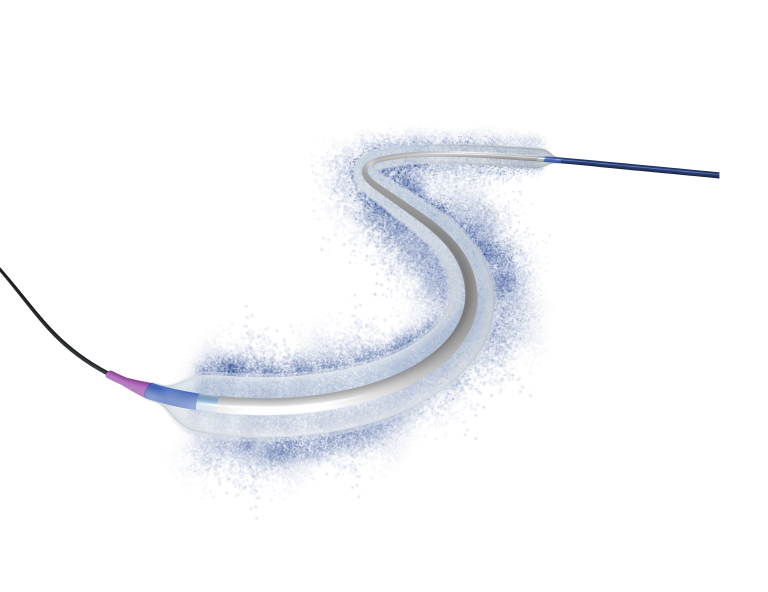 LUMIFOLLOW Registry Confirms Sustained 3-Year Performance of Luminor in Real-World Femoropopliteal Disease