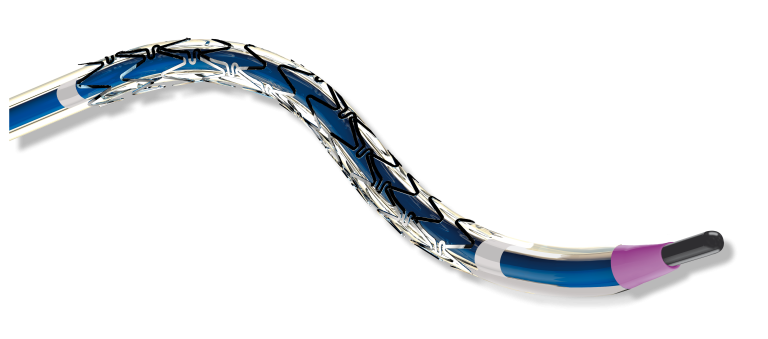 BARISTA Trial Demonstrates Excellent 1-Year Outcomes with Restorer in the Treatment of Iliac Artery Lesions